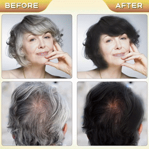 Apple Hair Color Shampoo (Original + Ammonia-Free) for Men & Women