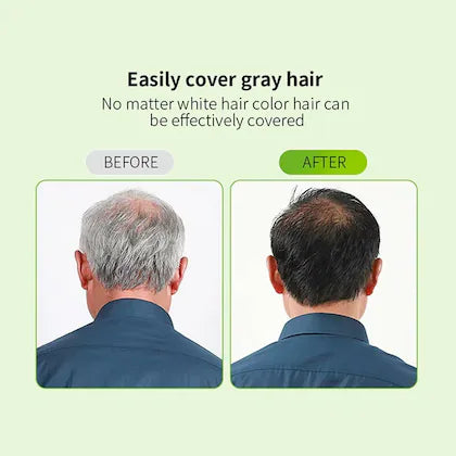 Apple Hair Color Shampoo (Original + Ammonia-Free) for Men & Women